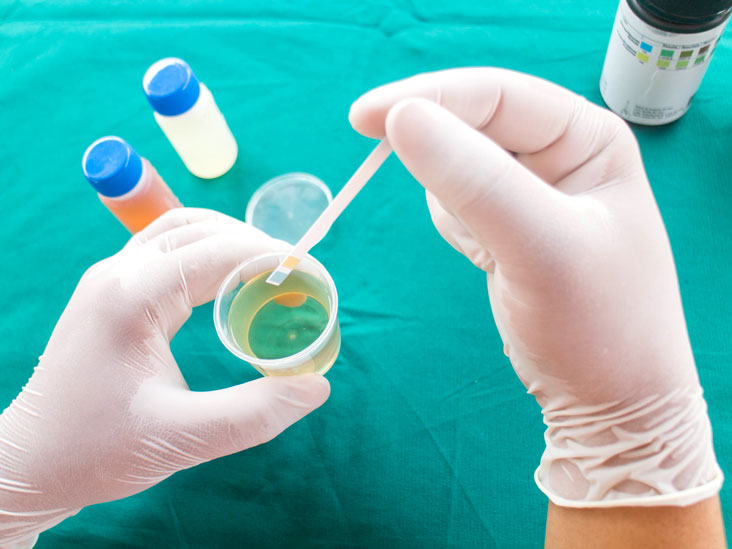 <span class="entry-title-primary">Bilirubin Blood Test Market | Global Industry Analysis, Segments</span> <span class="entry-subtitle">Global Bilirubin Blood Test Market Report</span><span class="rating-result after_title mr-filter rating-result-34248">	<span class="mr-star-rating">			    <i class="fa fa-star mr-star-full"></i>	    	    <i class="fa fa-star mr-star-full"></i>	    	    <i class="fa fa-star mr-star-full"></i>	    	    <i class="fa fa-star mr-star-full"></i>	    	    <i class="fa fa-star mr-star-full"></i>	    </span><span class="star-result">	5/5</span>			<span class="count">				(1)			</span>			</span>