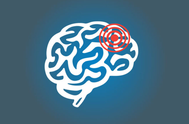 <span class="entry-title-primary">Brain Aneurysm Market Analysis, Trends, Share, Growth, Forecast to 2025</span> <span class="entry-subtitle">Global Brain Aneurysm Market</span><span class="rating-result after_title mr-filter rating-result-34255">	<span class="mr-star-rating">			    <i class="fa fa-star mr-star-full"></i>	    	    <i class="fa fa-star mr-star-full"></i>	    	    <i class="fa fa-star mr-star-full"></i>	    	    <i class="fa fa-star mr-star-full"></i>	    	    <i class="fa fa-star mr-star-full"></i>	    </span><span class="star-result">	5/5</span>			<span class="count">				(1)			</span>			</span>