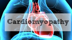 <span class="entry-title-primary">Cardiomyopathy Market Size, Demand And Trends Forecast</span> <span class="entry-subtitle">Global Cardiomyopathy Market Report</span>