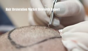 <span class="entry-title-primary">Hair Restoration Market Size, Share, Trend, Demand, Growth, Analysis and Forecast Report</span> <span class="entry-subtitle">Global Hair Restoration Market Report</span>