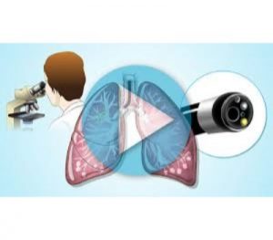 <span class="entry-title-primary">Lung Cancer Diagnosis and Therapeutics Market by Type | Application | Manufacturers | Demand |</span> <span class="entry-subtitle">Global Lung Cancer Diagnosis and Therapeutics Market  Report</span>