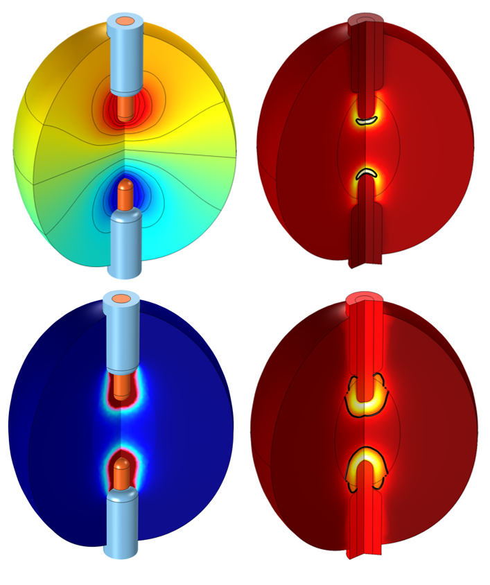 <span class="entry-title-primary">Tissue Ablation Market Analysis, Trends, Forecast, 2019-2026</span> <span class="entry-subtitle">Global Tissue Ablation Market Research</span><span class="rating-result after_title mr-filter rating-result-34606">	<span class="mr-star-rating">			    <i class="fa fa-star mr-star-full"></i>	    	    <i class="fa fa-star mr-star-full"></i>	    	    <i class="fa fa-star mr-star-full"></i>	    	    <i class="fa fa-star mr-star-full"></i>	    	    <i class="fa fa-star mr-star-full"></i>	    </span><span class="star-result">	5/5</span>			<span class="count">				(1)			</span>			</span>