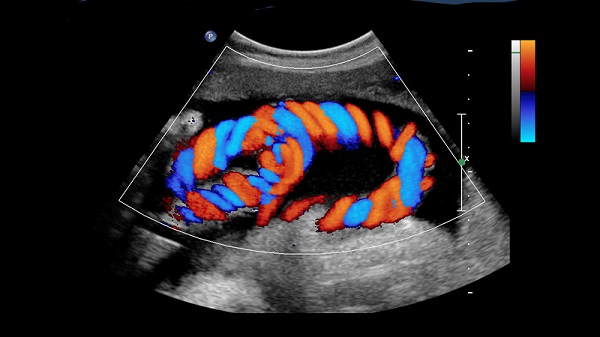 <span class="entry-title-primary">Ultrasound Imaging Market Growth, Trends, Industry Analysis And Forecasts 2019</span> <span class="entry-subtitle">Ultrasound Imaging Market Report</span><span class="rating-result after_title mr-filter rating-result-34627">	<span class="mr-star-rating">			    <i class="fa fa-star mr-star-full"></i>	    	    <i class="fa fa-star mr-star-full"></i>	    	    <i class="fa fa-star mr-star-full"></i>	    	    <i class="fa fa-star mr-star-full"></i>	    	    <i class="fa fa-star mr-star-full"></i>	    </span><span class="star-result">	5/5</span>			<span class="count">				(1)			</span>			</span>