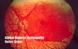 <span class="entry-title-primary">Diabetic Retinopathy Market Report | 2019-2026</span> <span class="entry-subtitle">Global Diabetic Retinopathy Market </span>