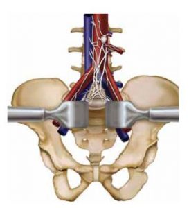 <span class="entry-title-primary">Interbody Fusion Market 2019 | Global Market Size, Share, Supply, Demand</span> <span class="entry-subtitle">Global Interbody Fusion Market Report</span>