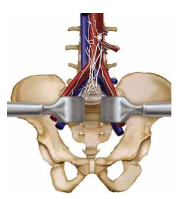 <span class="entry-title-primary">Interbody Fusion Market 2019 | Global Market Size, Share, Supply, Demand</span> <span class="entry-subtitle">Global Interbody Fusion Market Report</span><span class="rating-result after_title mr-filter rating-result-36234">			<span class="no-rating-results-text">No ratings yet.</span>		</span>