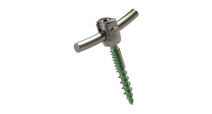 <span class="entry-title-primary">Pedicle Screw Market Analysis, Size, Share and Forecast 2019 – 2024</span> <span class="entry-subtitle">Global Pedicle Screw Market  Report</span><span class="rating-result after_title mr-filter rating-result-37631">			<span class="no-rating-results-text">No ratings yet.</span>		</span>