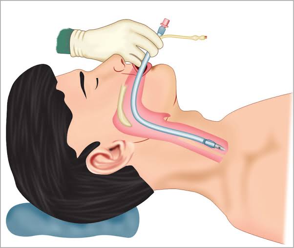 <span class="entry-title-primary">Tracheal Intubation Market Size by Players, By Applications, Types, 2025 Forecast Report</span> <span class="entry-subtitle">Global Tracheal Intubation Market Report</span><span class="rating-result after_title mr-filter rating-result-36522">			<span class="no-rating-results-text">No ratings yet.</span>		</span>