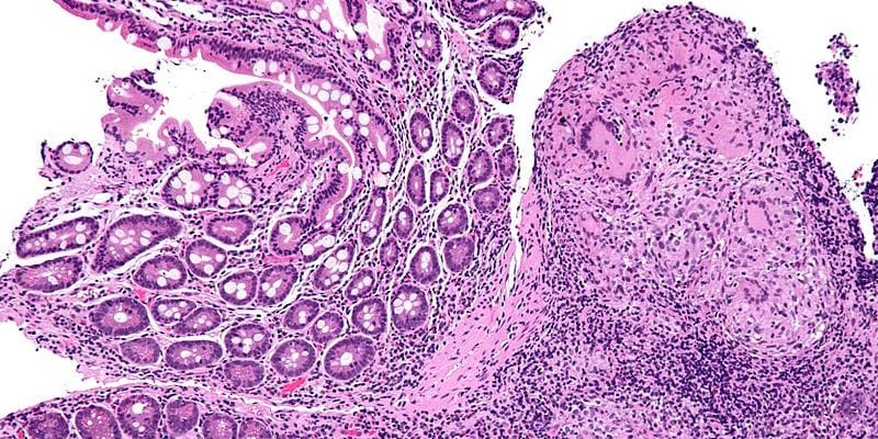 <span class="entry-title-primary">Global Ustekinumab Market Industry Analysis, Trends, Growth</span> <span class="entry-subtitle">Global Ustekinumab Market Industry Analysis, Trends, Growth</span><span class="rating-result after_title mr-filter rating-result-36367">			<span class="no-rating-results-text">No ratings yet.</span>		</span>