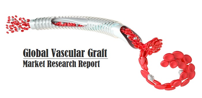 <span class="entry-title-primary">Vascular Graft Market to Soar at Steady CAGR of 5.7% Globally</span> <span class="entry-subtitle">Global Vascular Graft Market Report</span><span class="rating-result after_title mr-filter rating-result-36430">			<span class="no-rating-results-text">No ratings yet.</span>		</span>