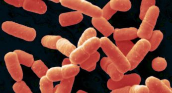 Bacillus Coagulans Market Global Market Segmentation and key Players Analysis