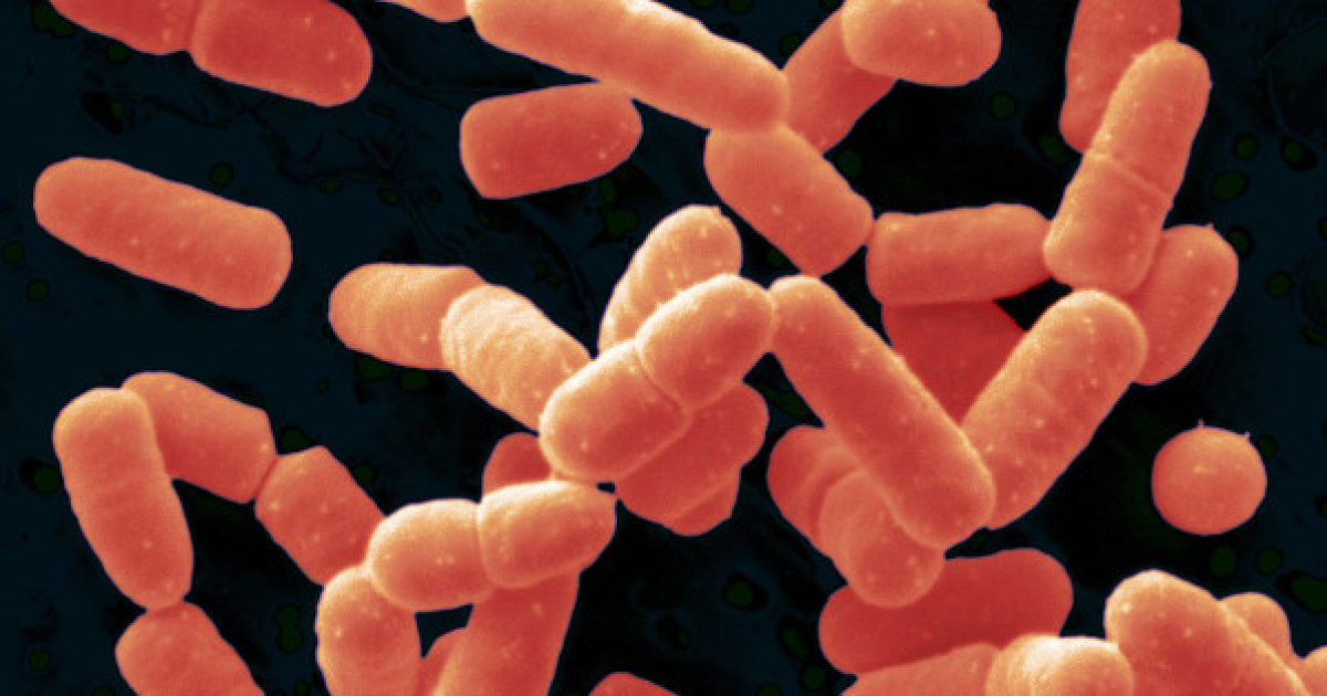 <span class="entry-title-primary">Bacillus Coagulans Market Global Market Segmentation and key Players Analysis</span> <span class="entry-subtitle">Global Bacillus Coagulans Market Report</span><span class="rating-result after_title mr-filter rating-result-39078">			<span class="no-rating-results-text">No ratings yet.</span>		</span>