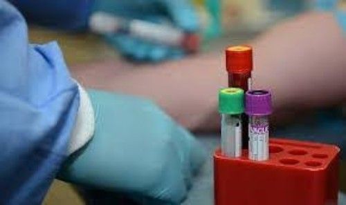 <span class="entry-title-primary">Blood Collection, Processing, Management Devices, and Consumables Market Share, Size, Trends</span> <span class="entry-subtitle">Global Blood Collection, Processing, Management Devices, and Consumables Market Report</span><span class="rating-result after_title mr-filter rating-result-39082">			<span class="no-rating-results-text">No ratings yet.</span>		</span>