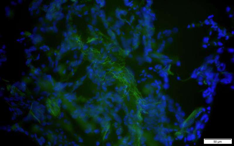 <span class="entry-title-primary">CD14 (Antibody) Market Trends, Share, Industry Size, Growth</span> <span class="entry-subtitle">Global CD14 (Antibody) Market</span><span class="rating-result after_title mr-filter rating-result-38863">			<span class="no-rating-results-text">No ratings yet.</span>		</span>