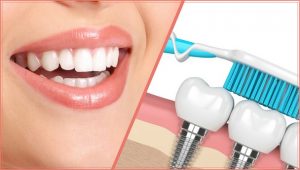 <span class="entry-title-primary">Cosmetic Implant Market Types and Applications, Status and Forecast to 2024</span> <span class="entry-subtitle">Global Cosmetic Implant Market  Report</span>