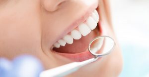 <span class="entry-title-primary">Dental Bonding Agents Market Share, Growth, Trend and Forecast – 2024</span> <span class="entry-subtitle">Global Dental Bonding Agents Market Report</span>