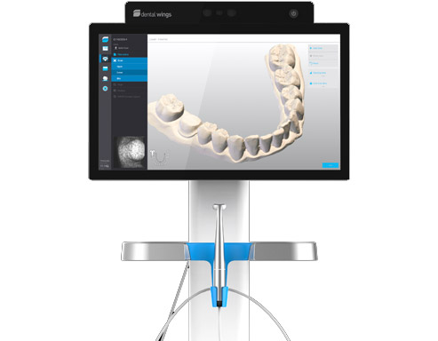 <span class="entry-title-primary">Intraoral Scanner Market Size by Players, By Applications, Types</span> <span class="entry-subtitle">Global Intraoral Scanner Market Report</span><span class="rating-result after_title mr-filter rating-result-38122">			<span class="no-rating-results-text">No ratings yet.</span>		</span>