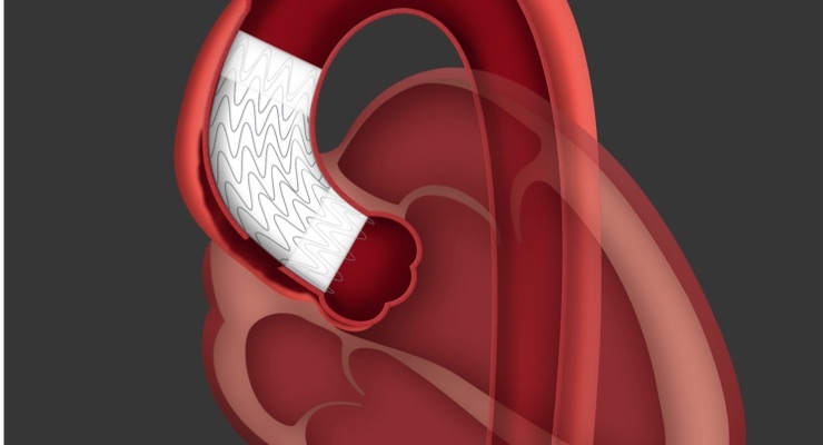 <span class="entry-title-primary">Stents And Related Implants Market Size and Share: Industry Forecast 2024</span> <span class="entry-subtitle">Global Stents And Related Implants Market Report</span><span class="rating-result after_title mr-filter rating-result-40252">			<span class="no-rating-results-text">No ratings yet.</span>		</span>