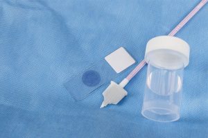 <span class="entry-title-primary">Cervical Cancer Diagnostic Tests Market Report, Analysis, and Forecast to 2020-2026</span> <span class="entry-subtitle">Global Cervical Cancer Diagnostic Tests Market Report</span>