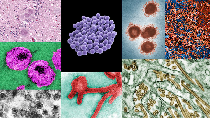 <span class="entry-title-primary">Communicable Diseases Treatment Market Application,Trends And Growth Factors And Development Forecast To 2026</span> <span class="entry-subtitle">Global Communicable Diseases Treatment Market Report</span><span class="rating-result after_title mr-filter rating-result-41139">	<span class="mr-star-rating">			    <i class="fa fa-star mr-star-full"></i>	    	    <i class="fa fa-star mr-star-full"></i>	    	    <i class="fa fa-star mr-star-full"></i>	    	    <i class="fa fa-star mr-star-full"></i>	    	    <i class="fa fa-star mr-star-full"></i>	    </span><span class="star-result">	5/5</span>			<span class="count">				(1)			</span>			</span>