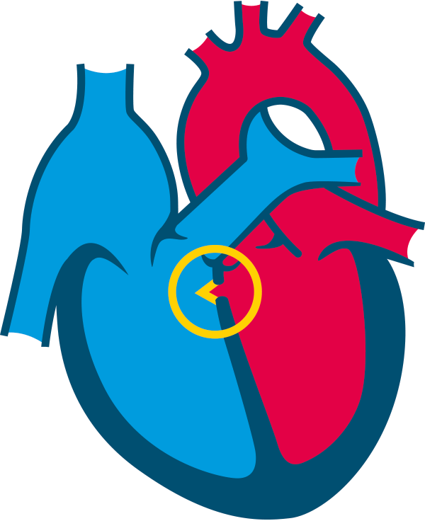 <span class="entry-title-primary">Congenital Heart Disease Occluder Market Industry Research and End User Analysis, Outlook 2020-2026</span> <span class="entry-subtitle">Global Congenital Heart Disease Occluder Market Report</span><span class="rating-result after_title mr-filter rating-result-41703">			<span class="no-rating-results-text">No ratings yet.</span>		</span>