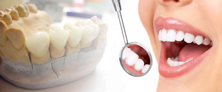 <span class="entry-title-primary">Dental Prosthetics Market Insights, Analysis, Opportunities, Growth Potential and Forecast 2020 – 2026</span> <span class="entry-subtitle">Global Dental Prosthetics Market Report</span><span class="rating-result after_title mr-filter rating-result-41412">			<span class="no-rating-results-text">No ratings yet.</span>		</span>