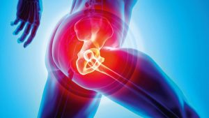 <span class="entry-title-primary">HIP Replacement Market  | Growth, Trends, and Forecast 2020-2026</span> <span class="entry-subtitle">Global HIP Replacement Market  Report</span>