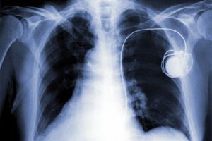 <span class="entry-title-primary">Implantable Medical Devices Market Trends, Industry Analysis And Forecasts (2020-2026)</span> <span class="entry-subtitle">Global Implantable Medical Devices Market Report</span>