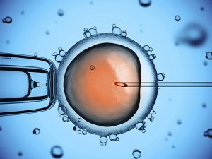 <span class="entry-title-primary">In-Vitro Fertilization Market Industry Insights, Company Overview and Investment Analysis</span> <span class="entry-subtitle">Global In-Vitro Fertilization Market Report</span>