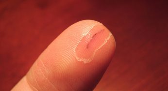 Liquid Bandage Market | Manufacturers | Demand | Forecast by 2026