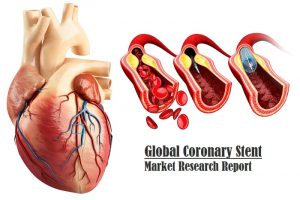 <span class="entry-title-primary">Coronary Stent Market Worth USD 12.63 Billion by 2026 | CAGR 9.32% Globally</span> <span class="entry-subtitle">Worldwide Coronary Stent Market Report</span>