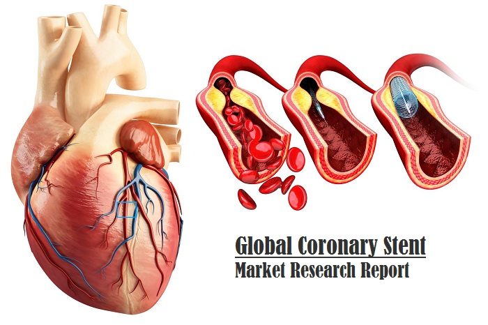 <span class="entry-title-primary">Coronary Stent Market Worth USD 12.63 Billion by 2026 | CAGR 9.32% Globally</span> <span class="entry-subtitle">Worldwide Coronary Stent Market Report</span><span class="rating-result after_title mr-filter rating-result-44528">			<span class="no-rating-results-text">No ratings yet.</span>		</span>