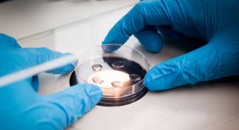Pneumonia Diagnostic Market Sales, Revenue, Outlook And Forecast to 2026