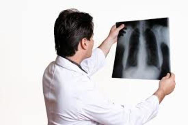 <span class="entry-title-primary">Radiographic Film Market Growth, Size, Application And  Forecast 2026</span> <span class="entry-subtitle">Global Radiographic Film Market Report</span><span class="rating-result after_title mr-filter rating-result-44349">			<span class="no-rating-results-text">No ratings yet.</span>		</span>