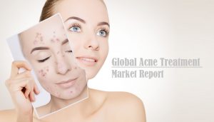 <span class="entry-title-primary">Acne Treatment Market Size Is To Reach 5.2% CAGR by 2026 Globally</span> <span class="entry-subtitle">Global Acne Treatment Market Report</span>