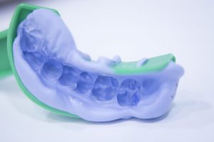 <span class="entry-title-primary">Dental Impression Systems Market Application,Trends And Growth Factors</span> <span class="entry-subtitle">Global Dental Impression Systems Market Report </span>