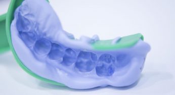 Dental Impression Systems Market Application,Trends And Growth Factors