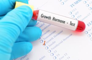 <span class="entry-title-primary">Growth Hormone Market | Human Growth Hormone (HGH) Market | Global Industry Outlook and Growth by 2026</span> <span class="entry-subtitle">Global Growth Hormone Market Report</span>