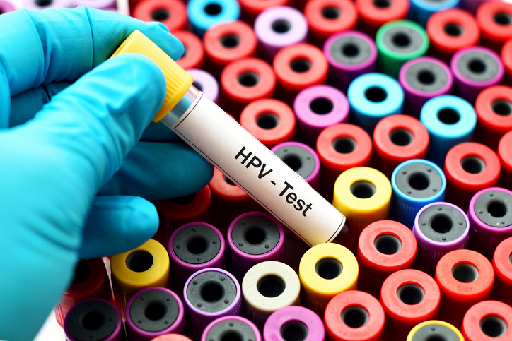 <span class="entry-title-primary">HPV Testing Market Share,Trend,Segmentation and Forecast</span> <span class="entry-subtitle">Global Share,Trend,Segmentation and Forecast Report</span><span class="rating-result after_title mr-filter rating-result-45240">			<span class="no-rating-results-text">No ratings yet.</span>		</span>