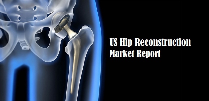 <span class="entry-title-primary">US Hip Reconstruction Market Growth, Trends, Types, Regional Demand and Forecast Report by 2026</span> <span class="entry-subtitle">US Hip Reconstruction Market Report</span><span class="rating-result after_title mr-filter rating-result-45296">			<span class="no-rating-results-text">No ratings yet.</span>		</span>