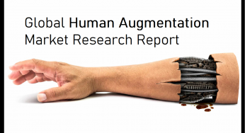 Global Human Augmentation Market Analysis, Size, Share, Development, Trends