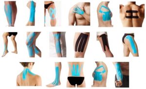 <span class="entry-title-primary">Kinesio Tape Market Analysis By Product, Application, Region and Segment Forecasts 2026</span> <span class="entry-subtitle">Global Kinesio Tape Market Report</span>