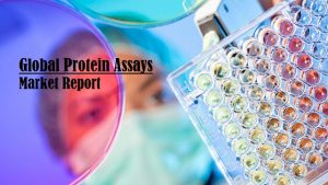 <span class="entry-title-primary">Protein Assays Market Size, Share and Analysis | Forecast Report by 2026</span> <span class="entry-subtitle">Global Protein Assays Market Report by Technology, Applications, Products, Types, End User and Forecast Analysis</span>