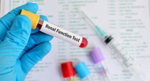 <span class="entry-title-primary">Renal Function Test Product Market Key Opportunity, Application And Forecast 2025</span> <span class="entry-subtitle">Global Renal Function Test Product Market Report</span>