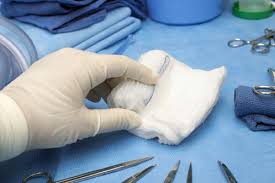 <span class="entry-title-primary">Surgical Sponge Market Status, Top Players, Trends</span> <span class="entry-subtitle">Surgical Sponge Market Research</span><span class="rating-result after_title mr-filter rating-result-47044">			<span class="no-rating-results-text">No ratings yet.</span>		</span>