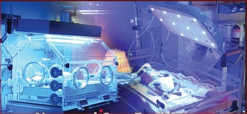 <span class="entry-title-primary">Neonatal Care Equipment Market Regions, Type and Application, Forecast to 2026</span> <span class="entry-subtitle">Global Neonatal Care Equipment Market Report</span><span class="rating-result after_title mr-filter rating-result-47356">			<span class="no-rating-results-text">No ratings yet.</span>		</span>