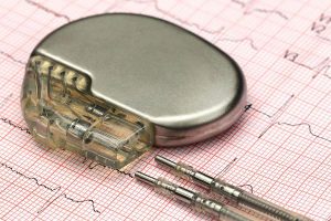 <span class="entry-title-primary">Global Pacemaker Devices Market Regions, Type and Application, Forecast</span> <span class="entry-subtitle">Pacemaker Devices Market Report</span>