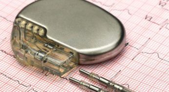 Global Pacemaker Devices Market Regions, Type and Application, Forecast